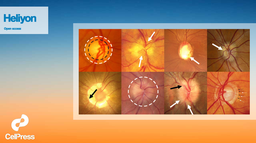 Multi-label deep learning for comprehensive optic nerve head segmentation through data of fundus images